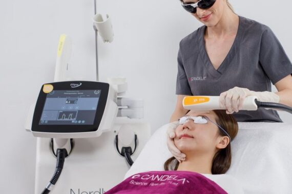 Laser Treatment Acne Laser Treatment