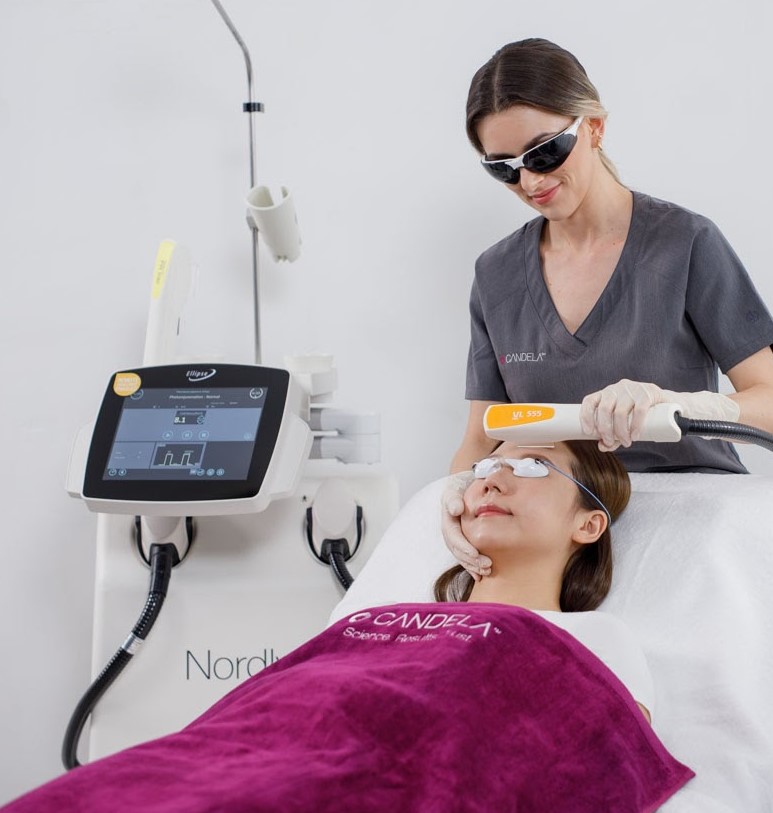 Laser Treatment Acne Laser Treatment