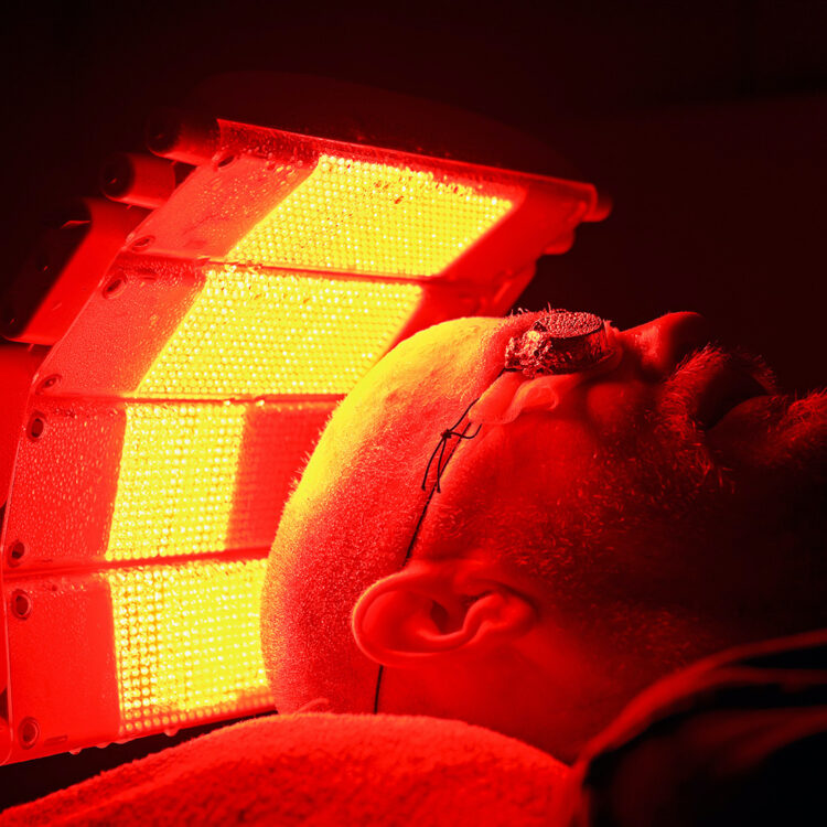 Photodynamic Therapy Pdt Skin Cancer Clinic Melbourne