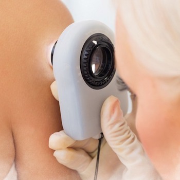 a Doctor examining sun spots on the skin at a clinic